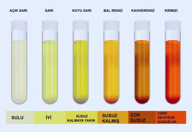 Fark Analizi Tetkiki