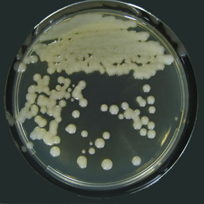 Staphylococcus Aureus Testi